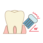teeth-cleaning006